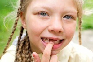 Kind mit Zahnlücke - Kieferorthopädie Herne